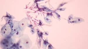 Question Your World: Why Does Old Fungi Matter?