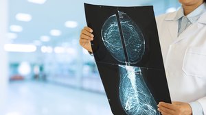 Question Your World: Can AI Detect Breast Cancer?