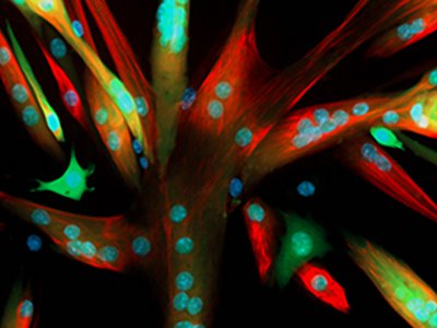 Kevin Murach image of culture grown muscle stem cells from a mouse