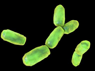 archaea under a microscope.jpg
